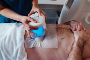 silhouette - cryolipolyse